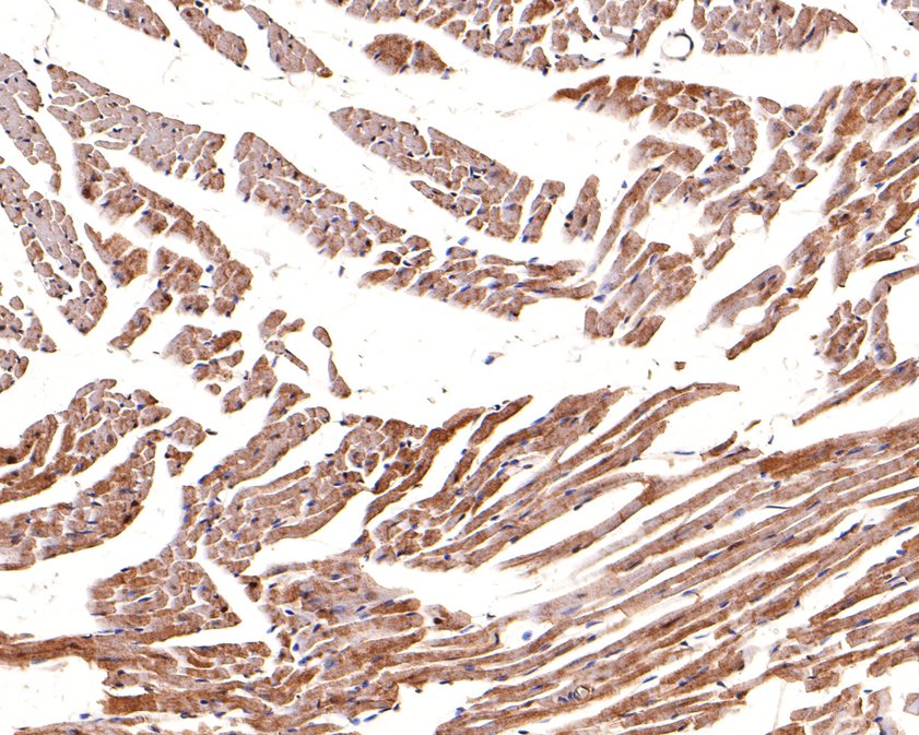 Immunohistochemical analysis of paraffin-embedded mouse heart tissue using anti-CNTFR antibody. The section was pre-treated using heat mediated antigen retrieval with Tris-EDTA buffer (pH 9.0) for 20 minutes.The tissues were blocked in 1% BSA for 30 minutes at room temperature, washed with ddH2O and PBS, and then probed with the primary antibody (HA500506, 1/200) for 30 minutes at room temperature. The detection was performed using an HRP conjugated compact polymer system. DAB was used as the chromogen. Tissues were counterstained with hematoxylin and mounted with DPX.