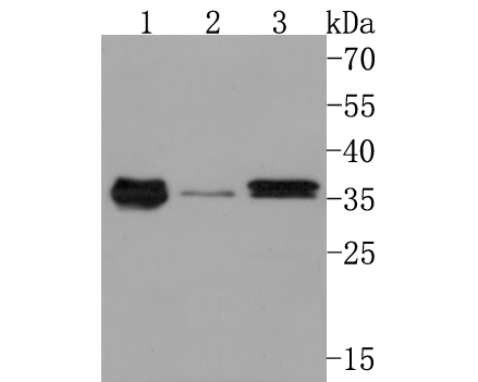 Western blot analysis of GNB4 on different lysates. Proteins were transferred to a PVDF membrane and blocked with 5% BSA in PBS for 1 hour at room temperature. The primary antibody (HA500501, 1/1,000) was used in 5% BSA at room temperature for 2 hours. Goat Anti-Rabbit IgG - HRP Secondary Antibody (HA1001) at 1:200,000 dilution was used for 1 hour at room temperature.<br />
Positive control: <br />
Lane 1: Human placenta tissue lysate<br />
Lane 2: 293 cell lysate<br />
Lane 3: A549 cell lysate