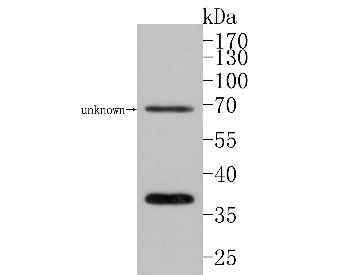 Western blot analysis of GNB4 on mouse brain lysates. Proteins were transferred to a PVDF membrane and blocked with 5% BSA in PBS for 1 hour at room temperature. The primary antibody (HA500501, 1/1,000) was used in 5% BSA at room temperature for 2 hours. Goat Anti-Rabbit IgG - HRP Secondary Antibody (HA1001) at 1:200,000 dilution was used for 1 hour at room temperature.