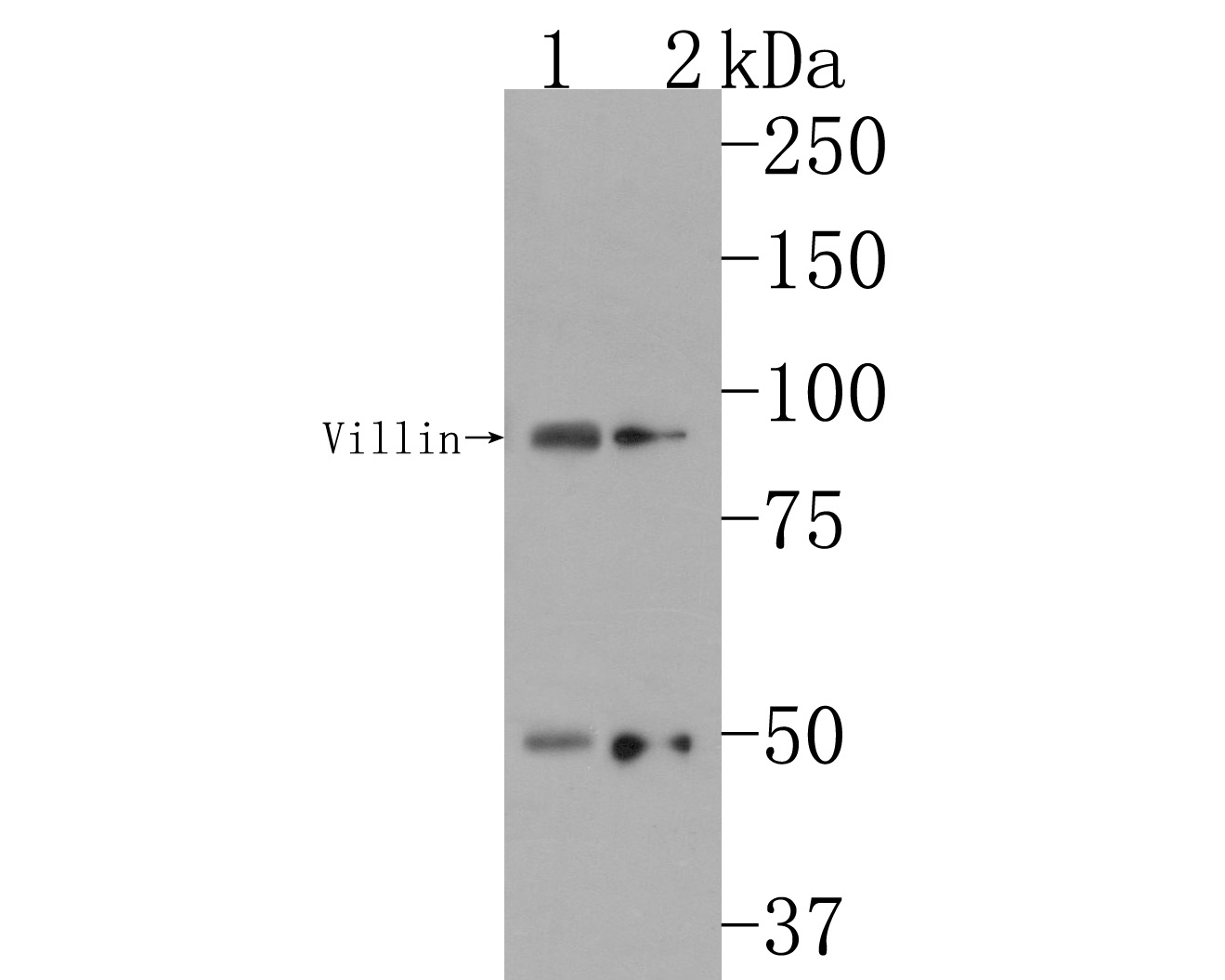 Western blot analysis of Villin1 on different lysates. Proteins were transferred to a PVDF membrane and blocked with 5% BSA in PBS for 1 hour at room temperature. The primary antibody (HA500509, 1/1,000) was used in 5% BSA at room temperature for 2 hours. Goat Anti-Rabbit IgG - HRP Secondary Antibody (HA1001) at 1:200,000 dilution was used for 1 hour at room temperature.<br />
Positive control: <br />
Lane 1: Human kidney tissue lysate<br />
Lane 2: 293 cell lysate
