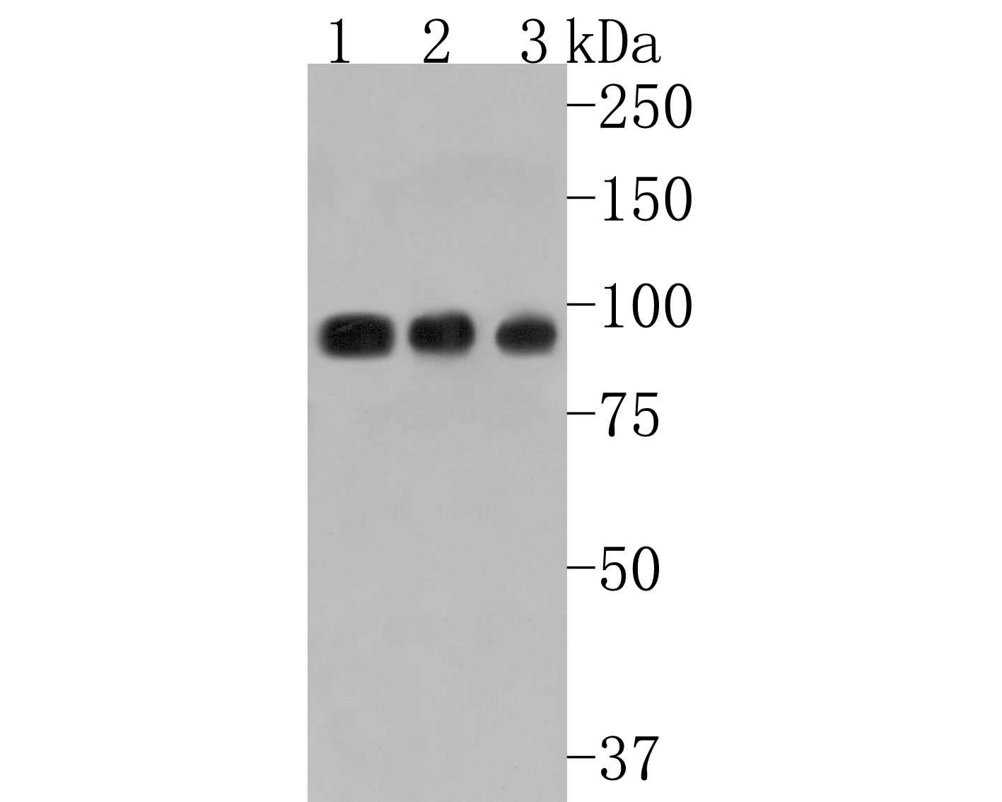 Western blot analysis of Villin1 on different lysates. Proteins were transferred to a PVDF membrane and blocked with 5% BSA in PBS for 1 hour at room temperature. The primary antibody (HA500509, 1/2,000) was used in 5% BSA at room temperature for 2 hours. Goat Anti-Rabbit IgG - HRP Secondary Antibody (HA1001) at 1:200,000 dilution was used for 1 hour at room temperature.<br />
Positive control: <br />
Lane 1: Mouse colon tissue lysate<br />
Lane 2: Rat kidney tissue lysate<br />
Lane 2: Rat colon tissue lysate