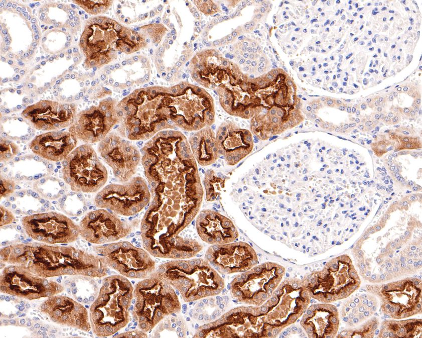 Immunohistochemical analysis of paraffin-embedded human kidney tissue using anti-Villin1 antibody. The section was pre-treated using heat mediated antigen retrieval with Tris-EDTA buffer (pH 9.0) for 20 minutes.The tissues were blocked in 1% BSA for 30 minutes at room temperature, washed with ddH2O and PBS, and then probed with the primary antibody (HA500509, 1/600) for 30 minutes at room temperature. The detection was performed using an HRP conjugated compact polymer system. DAB was used as the chromogen. Tissues were counterstained with hematoxylin and mounted with DPX.