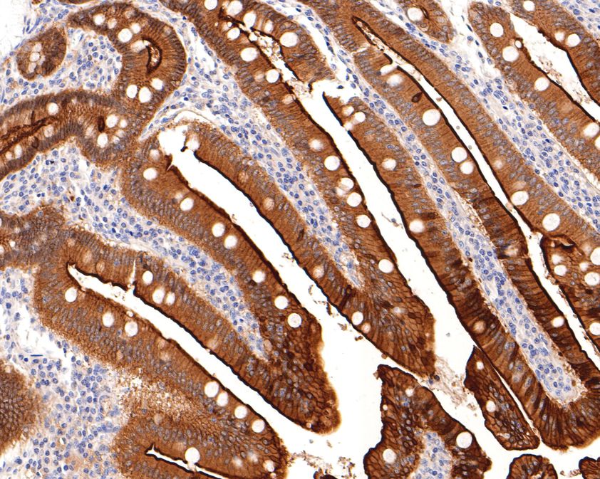 Immunohistochemical analysis of paraffin-embedded human small intestine tissue using anti-Villin1 antibody. The section was pre-treated using heat mediated antigen retrieval with Tris-EDTA buffer (pH 9.0) for 20 minutes.The tissues were blocked in 1% BSA for 30 minutes at room temperature, washed with ddH2O and PBS, and then probed with the primary antibody (HA500509, 1/600) for 30 minutes at room temperature. The detection was performed using an HRP conjugated compact polymer system. DAB was used as the chromogen. Tissues were counterstained with hematoxylin and mounted with DPX.