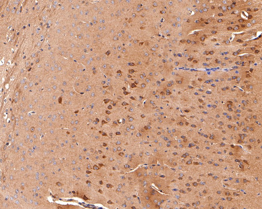 Immunohistochemical analysis of paraffin-embedded mouse brain tissue using anti-KCNIP2 antibody. The section was pre-treated using heat mediated antigen retrieval with Tris-EDTA buffer (pH 9.0) for 20 minutes.The tissues were blocked in 1% BSA for 30 minutes at room temperature, washed with ddH2O and PBS, and then probed with the primary antibody (HA500491, 1/600) for 30 minutes at room temperature. The detection was performed using an HRP conjugated compact polymer system. DAB was used as the chromogen. Tissues were counterstained with hematoxylin and mounted with DPX.