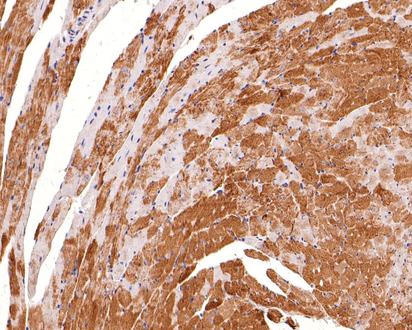 Immunohistochemical analysis of paraffin-embedded mouse heart tissue using anti-KCNIP2 antibody. The section was pre-treated using heat mediated antigen retrieval with Tris-EDTA buffer (pH 9.0) for 20 minutes.The tissues were blocked in 1% BSA for 30 minutes at room temperature, washed with ddH2O and PBS, and then probed with the primary antibody (HA500491, 1/600) for 30 minutes at room temperature. The detection was performed using an HRP conjugated compact polymer system. DAB was used as the chromogen. Tissues were counterstained with hematoxylin and mounted with DPX.