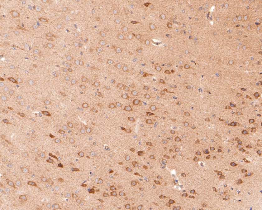 Immunohistochemical analysis of paraffin-embedded rat brain tissue using anti-KCNIP2 antibody. The section was pre-treated using heat mediated antigen retrieval with Tris-EDTA buffer (pH 9.0) for 20 minutes.The tissues were blocked in 1% BSA for 30 minutes at room temperature, washed with ddH2O and PBS, and then probed with the primary antibody (HA500491, 1/600) for 30 minutes at room temperature. The detection was performed using an HRP conjugated compact polymer system. DAB was used as the chromogen. Tissues were counterstained with hematoxylin and mounted with DPX.