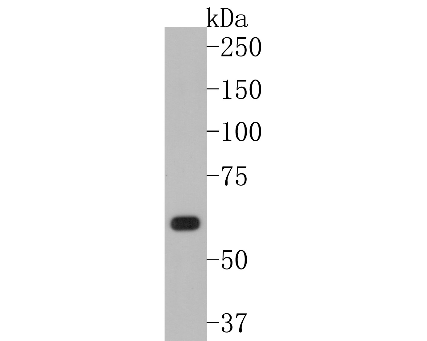 Western blot analysis of WASP/Wiskott-Aldrich syndrome protein on rat bone marrow tissue lysates. Proteins were transferred to a PVDF membrane and blocked with 5% BSA in PBS for 1 hour at room temperature. The primary antibody (HA500490, 1/1,000) was used in 5% BSA at room temperature for 2 hours. Goat Anti-Rabbit IgG - HRP Secondary Antibody (HA1001) at 1:200,000 dilution was used for 1 hour at room temperature.