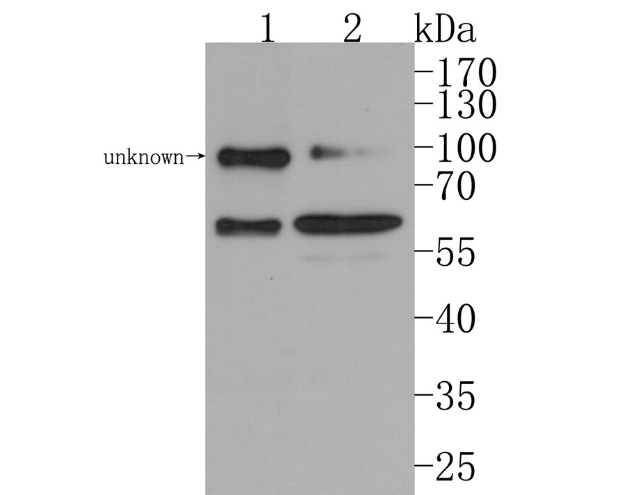 Western blot analysis of WASP/Wiskott-Aldrich syndrome protein on different lysates. Proteins were transferred to a PVDF membrane and blocked with 5% BSA in PBS for 1 hour at room temperature. The primary antibody (HA500490, 1/500) was used in 5% BSA at room temperature for 2 hours. Goat Anti-Rabbit IgG - HRP Secondary Antibody (HA1001) at 1:200,000 dilution was used for 1 hour at room temperature.<br />
Positive control: <br />
Lane 1: Jurkat cell lysate<br />
Lane 2: Daudi cell lysate