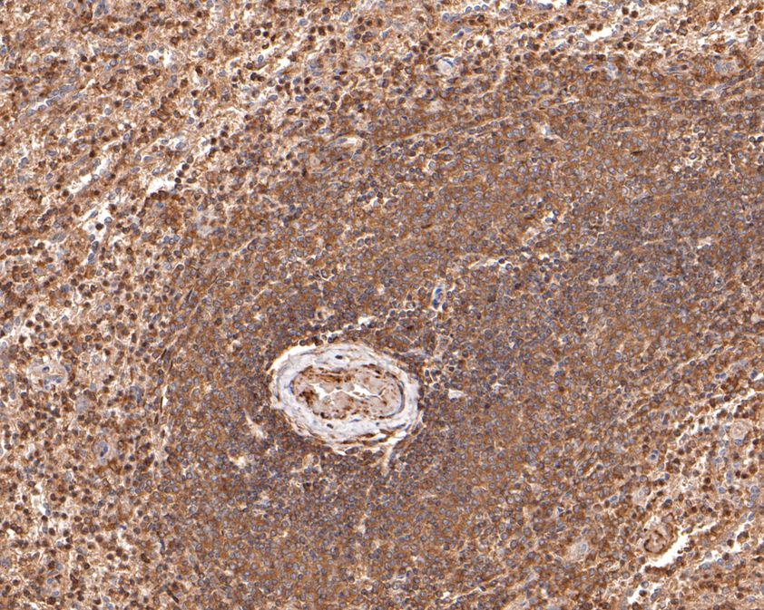Immunohistochemical analysis of paraffin-embedded human spleen tissue using anti-WASP/Wiskott-Aldrich syndrome protein antibody. The section was pre-treated using heat mediated antigen retrieval with sodium citrate buffer (pH 6.0) for 20 minutes. The tissues were blocked in 1% BSA for 30 minutes at room temperature, washed with ddH2O and PBS, and then probed with the primary antibody (HA500490, 1/600)  for 30 minutes at room temperature. The detection was performed using an HRP conjugated compact polymer system. DAB was used as the chromogen. Tissues were counterstained with hematoxylin and mounted with DPX.