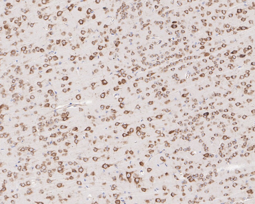 Immunohistochemical analysis of paraffin-embedded human pancreas tissue using anti-RPS6 antibody. The section was pre-treated using heat mediated antigen retrieval with sodium citrate buffer (pH 6.0) for 20 minutes. The tissues were blocked in 1% BSA for 30 minutes at room temperature, washed with ddH2O and PBS, and then probed with the primary antibody (HA600081, 1/600)  for 30 minutes at room temperature. The detection was performed using an HRP conjugated compact polymer system. DAB was used as the chromogen. Tissues were counterstained with hematoxylin and mounted with DPX.
