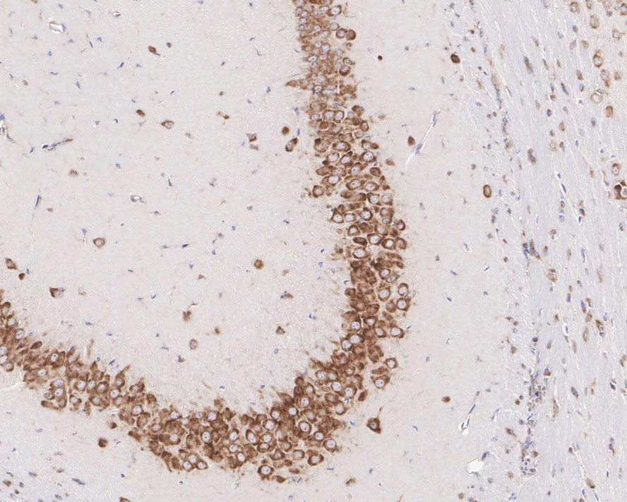 Immunohistochemical analysis of paraffin-embedded rat brain tissue using anti-RPS6 antibody. The section was pre-treated using heat mediated antigen retrieval with sodium citrate buffer (pH 6.0) for 20 minutes. The tissues were blocked in 1% BSA for 30 minutes at room temperature, washed with ddH2O and PBS, and then probed with the primary antibody (HA600081, 1/600)  for 30 minutes at room temperature. The detection was performed using an HRP conjugated compact polymer system. DAB was used as the chromogen. Tissues were counterstained with hematoxylin and mounted with DPX.