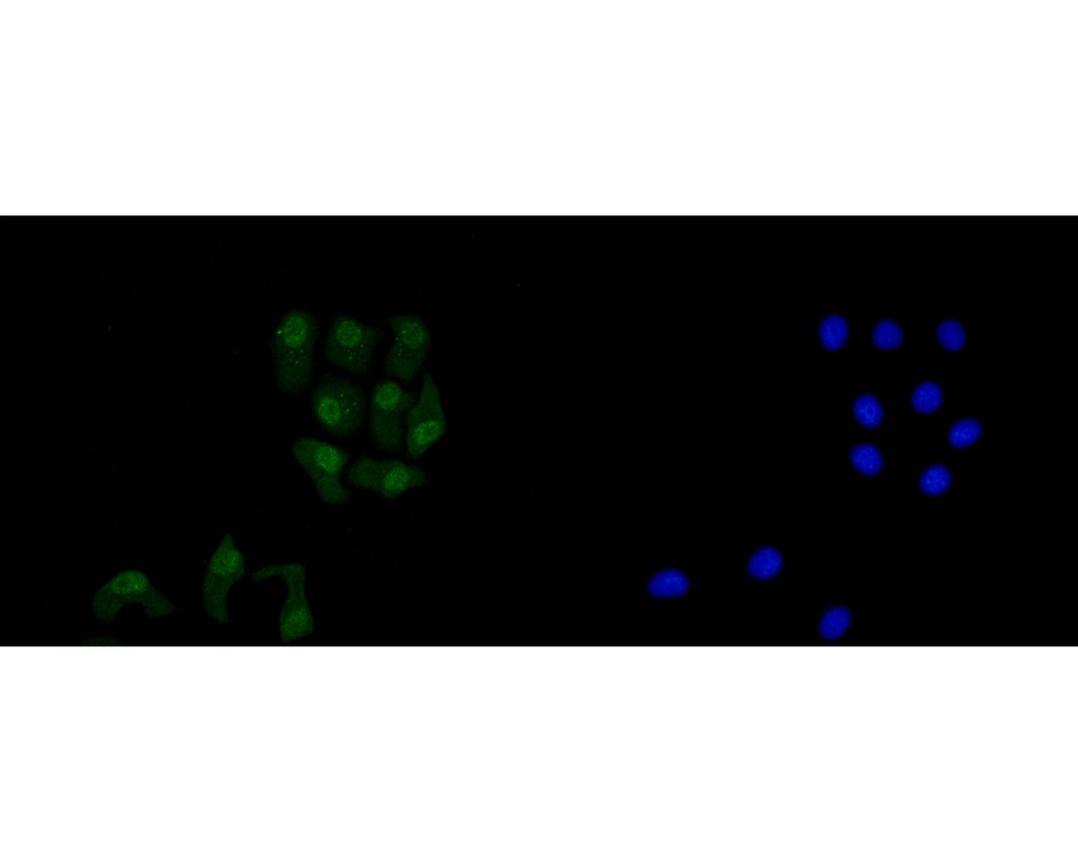 ICC staining of AMPK alpha 2 in Hela cells (green). Formalin fixed cells were permeabilized with 0.1% Triton X-100 in TBS for 10 minutes at room temperature and blocked with 10% negative goat serum for 15 minutes at room temperature. Cells were probed with the primary antibody (HA600079, 1/50) for 1 hour at room temperature, washed with PBS. Alexa Fluor®488 conjugate-Goat anti-Mouse IgG was used as the secondary antibody at 1/1,000 dilution. The nuclear counter stain is DAPI (blue).