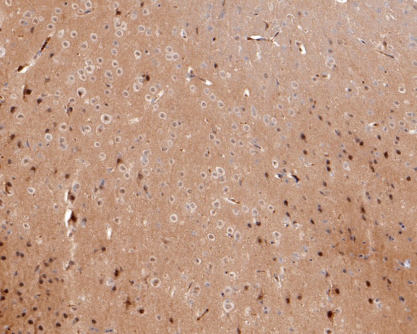 Immunohistochemical analysis of paraffin-embedded mouse brain tissue using anti-AMPK alpha 2 antibody. The section was pre-treated using heat mediated antigen retrieval with sodium citrate buffer (pH 6.0) for 20 minutes. The tissues were blocked in 1% BSA for 30 minutes at room temperature, washed with ddH2O and PBS, and then probed with the primary antibody (HA600079, 1/100)  for 30 minutes at room temperature. The detection was performed using an HRP conjugated compact polymer system. DAB was used as the chromogen. Tissues were counterstained with hematoxylin and mounted with DPX.