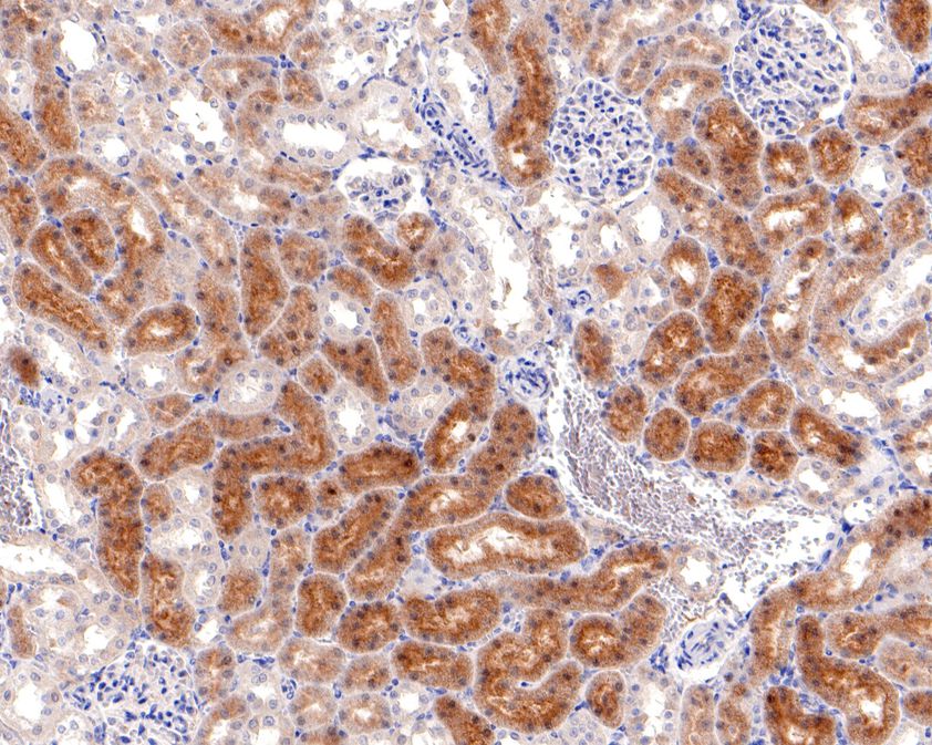 Immunohistochemical analysis of paraffin-embedded rat kidney tissue using anti-AMPK alpha 2 antibody. The section was pre-treated using heat mediated antigen retrieval with sodium citrate buffer (pH 6.0) for 20 minutes. The tissues were blocked in 1% BSA for 30 minutes at room temperature, washed with ddH2O and PBS, and then probed with the primary antibody (HA600079, 1/1,000)  for 30 minutes at room temperature. The detection was performed using an HRP conjugated compact polymer system. DAB was used as the chromogen. Tissues were counterstained with hematoxylin and mounted with DPX.