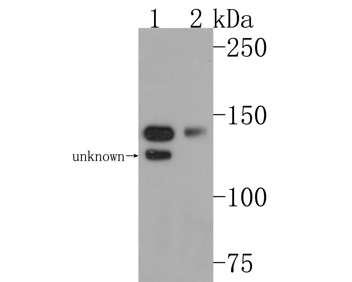 Western blot analysis of Aldehyde Oxidase on different lysates. Proteins were transferred to a PVDF membrane and blocked with 5% BSA in PBS for 1 hour at room temperature. The primary antibody (HA500504, 1/500) was used in 5% BSA at room temperature for 2 hours. Goat Anti-Rabbit IgG - HRP Secondary Antibody (HA1001) at 1:200,000 dilution was used for 1 hour at room temperature.<br />
Positive control: <br />
Lane 1: Mouse liver tissue lysate<br />
Lane 2: Rat liver tissue lysate