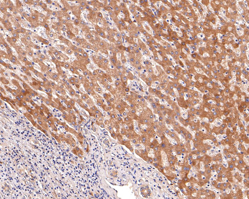 Immunohistochemical analysis of paraffin-embedded human liver tissue using anti-Aldehyde Oxidase antibody. The section was pre-treated using heat mediated antigen retrieval with Tris-EDTA buffer (pH 9.0) for 20 minutes.The tissues were blocked in 1% BSA for 30 minutes at room temperature, washed with ddH2O and PBS, and then probed with the primary antibody (HA500504, 1/600) for 30 minutes at room temperature. The detection was performed using an HRP conjugated compact polymer system. DAB was used as the chromogen. Tissues were counterstained with hematoxylin and mounted with DPX.