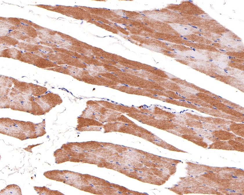 Immunohistochemical analysis of paraffin-embedded rat skeletal muscle tissue using anti-CYP1B1 antibody. The section was pre-treated using heat mediated antigen retrieval with Tris-EDTA buffer (pH 9.0) for 20 minutes.The tissues were blocked in 1% BSA for 30 minutes at room temperature, washed with ddH2O and PBS, and then probed with the primary antibody (HA500494, 1/200) for 30 minutes at room temperature. The detection was performed using an HRP conjugated compact polymer system. DAB was used as the chromogen. Tissues were counterstained with hematoxylin and mounted with DPX.