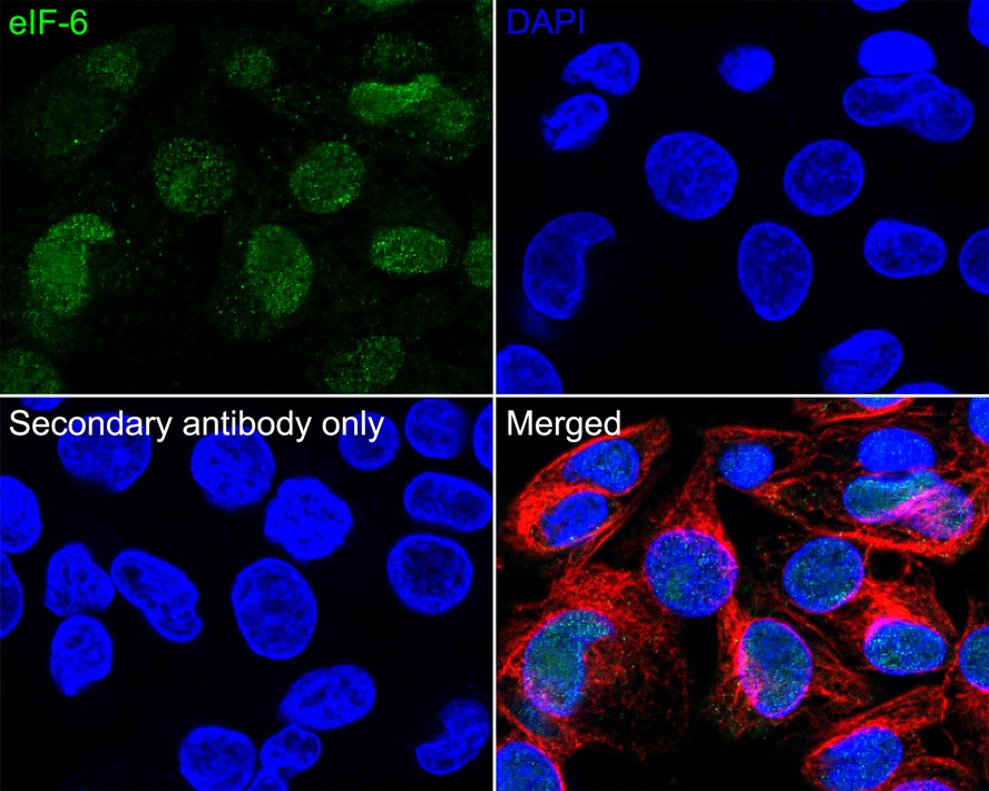 Immunofluorescence analysis of paraffin-embedded mouse brain tissue labeling beta Ⅲ tubulin (M0805-8) and Synaptophysin (ET1606-56).<br />
The section was pre-treated using heat mediated antigen retrieval with Tris-EDTA buffer (pH 9.0) for 20 minutes. The tissues were blocked in 10% negative goat serum for 1 hour at room temperature, washed with PBS. And then probed with the primary antibodies beta Ⅲ tubulin (M0805-8, green) at 1/200 dilution and Synaptophysin (ET1606-56, red) at 1/200 dilution at +4℃ overnight, washed with PBS. Goat Anti-Mouse IgG H&L (iFluor™ 488, HA1125) and Goat Anti-Rabbit IgG H&L (iFluor™ 594, HA1122) were used as the secondary antibodies at 1/1,000 dilution. DAPI was used as nuclear counterstain.