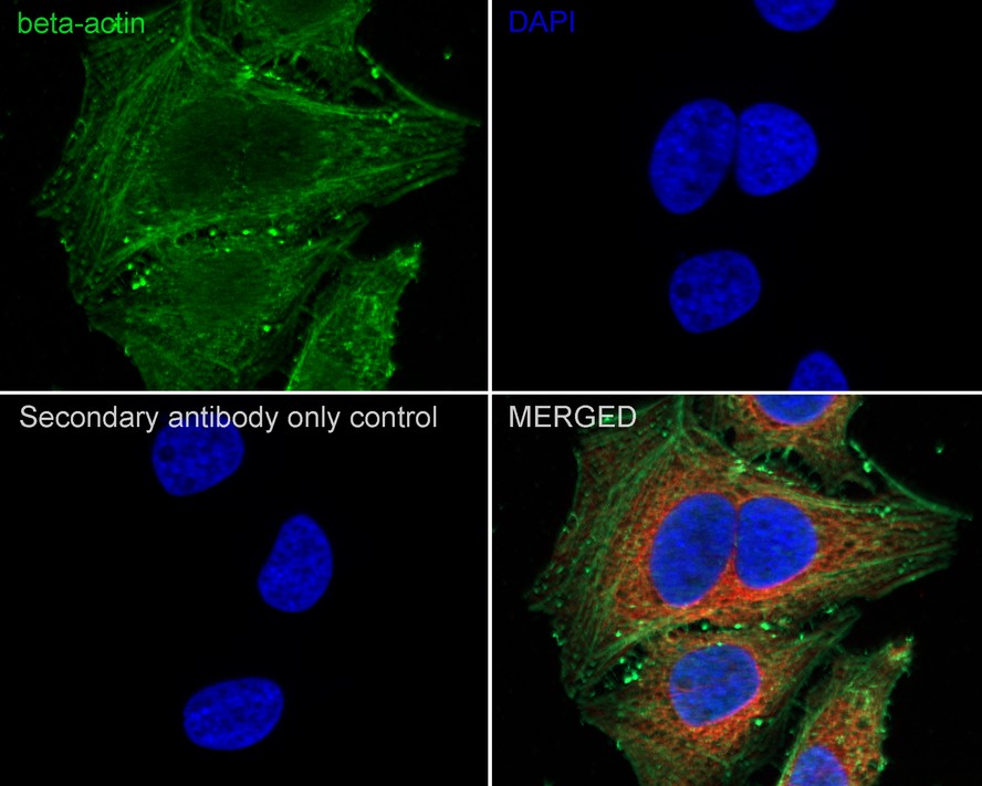 Immunofluorescence analysis of paraffin-embedded rat cerebellum tissue labeling GFAP (EM140707) and NeuN (ET1602-12).<br />
The section was pre-treated using heat mediated antigen retrieval with sodium citrate buffer (pH 6.0) for 20 minutes. The tissues were blocked in 10% negative goat serum for 1 hour at room temperature, washed with PBS. And then probed with the primary antibodies GFAP (EM140707, red) at 1/500 dilution and NeuN (ET1602-12, green) at 1/50 dilution at +4℃ overnight, washed with PBS. Goat Anti-Mouse IgG H&L (iFluor™ 594, HA1126) and Goat Anti-Rabbit IgG H&L (iFluor™ 488, HA1121) were used as the secondary antibodies at 1/1,000 dilution. DAPI was used as nuclear counterstain.