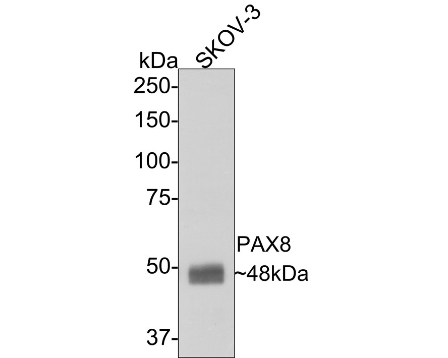 Immunohistochemical analysis of paraffin-embedded human thyroid tissue with Rabbit anti-PAX8 antibody (HA720112) at 1/5,000 dilution.<br />
<br />
The section was pre-treated using heat mediated antigen retrieval with sodium citrate buffer (pH 6.0) for 2 minutes. The tissues were blocked in 1% BSA for 20 minutes at room temperature, washed with ddH2O and PBS, and then probed with the primary antibody (HA720112) at 1/5,000 dilution for 1 hour at room temperature. The detection was performed using an HRP conjugated compact polymer system. DAB was used as the chromogen. Tissues were counterstained with hematoxylin and mounted with DPX.
