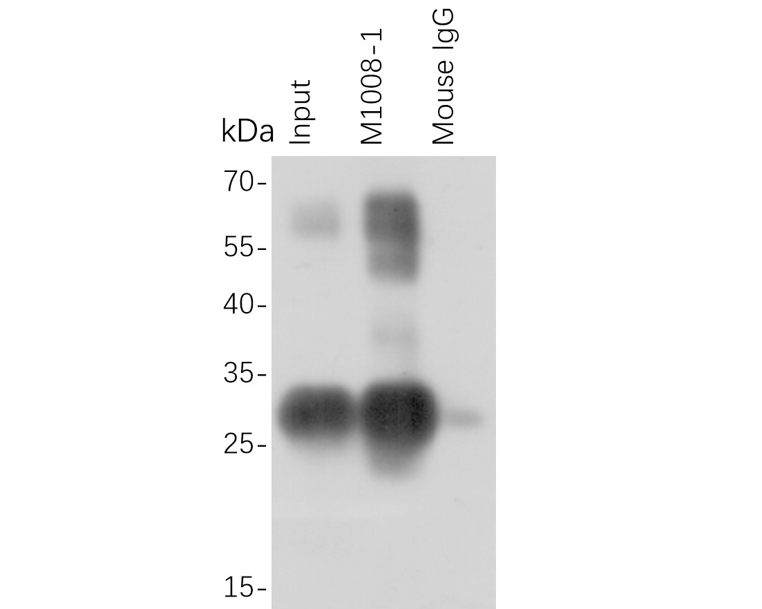 HA tag was immunoprecipitated in 5µg C terminal HA Tag fusion protein lysate with M1008-1 at 2 µg/20 µl agarose. Western blot was performed from the immunoprecipitate using ET1611-49 at 1/500 dilution. Anti-Rabbit IgG - HRP Secondary Antibody (HA1001) at 1:200,000 dilution was used for 60 mins at room temperature.<br />
<br />
Lane 1: HA Tag fusion protein lysate (input).<br />
Lane 2: M1008-1 IP in HA Tag fusion protein lysate.<br />
Lane 3: Mouse IgG instead of M1008-1 in HA Tag fusion protein lysate.<br />
<br />
Blocking/Dilution buffer: 5% NFDM/TBST
