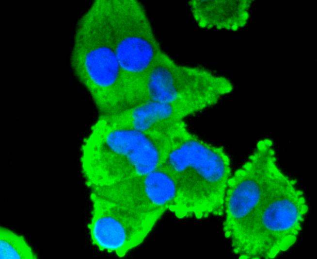 ICC staining of COX2/Cyclooxygenase 2 in A549 cells (green). Formalin fixed cells were permeabilized with 0.1% Triton X-100 in TBS for 10 minutes at room temperature and blocked with 1% Blocker BSA for 15 minutes at room temperature. Cells were probed with the primary antibody (ET1610-23, 1/50) for 1 hour at room temperature, washed with PBS. Alexa Fluor®488 Goat anti-Rabbit IgG was used as the secondary antibody at 1/1,000 dilution. The nuclear counter stain is DAPI (blue).