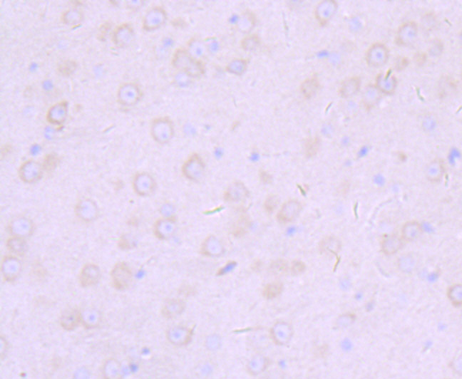 Immunohistochemical analysis of paraffin-embedded mouse brain tissue using anti-Furin antibody. The section was pre-treated using heat mediated antigen retrieval with Tris-EDTA buffer (pH 8.0-8.4) for 20 minutes.The tissues were blocked in 5% BSA for 30 minutes at room temperature, washed with ddH2O and PBS, and then probed with the primary antibody (ET7107-37, 1/50) for 30 minutes at room temperature. The detection was performed using an HRP conjugated compact polymer system. DAB was used as the chromogen. Tissues were counterstained with hematoxylin and mounted with DPX.