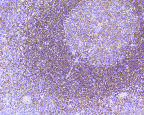 Immunohistochemical analysis of paraffin-embedded human tonsil tissue using anti-BTK antibody. The section was pre-treated using heat mediated antigen retrieval with sodium citrate buffer (pH 6.0) for 20 minutes. The tissues were blocked in 5% BSA for 30 minutes at room temperature, washed with ddH2O and PBS, and then probed with the primary antibody (ET1611-4, 1/50)  for 30 minutes at room temperature. The detection was performed using an HRP conjugated compact polymer system. DAB was used as the chromogen. Tissues were counterstained with hematoxylin and mounted with DPX.