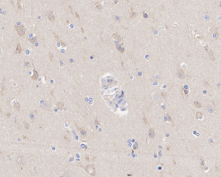 ICC staining of ATG5 in MCF-7 cells (green). Formalin fixed cells were permeabilized with 0.1% Triton X-100 in TBS for 10 minutes at room temperature and blocked with 1% Blocker BSA for 15 minutes at room temperature. Cells were probed with the primary antibody (ET1611-38, 1/50) for 1 hour at room temperature, washed with PBS. Alexa Fluor®488 Goat anti-Rabbit IgG was used as the secondary antibody at 1/1,000 dilution. The nuclear counter stain is DAPI (blue).