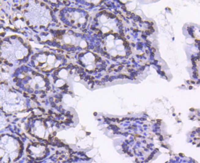Immunohistochemical analysis of paraffin-embedded mouse colon tissue using anti-Lamin B1 antibody. The section was pre-treated using heat mediated antigen retrieval with Tris-EDTA buffer (pH 8.0-8.4) for 20 minutes.The tissues were blocked in 5% BSA for 30 minutes at room temperature, washed with ddH2O and PBS, and then probed with the primary antibody (ET1606-27, 1/50) for 30 minutes at room temperature. The detection was performed using an HRP conjugated compact polymer system. DAB was used as the chromogen. Tissues were counterstained with hematoxylin and mounted with DPX.