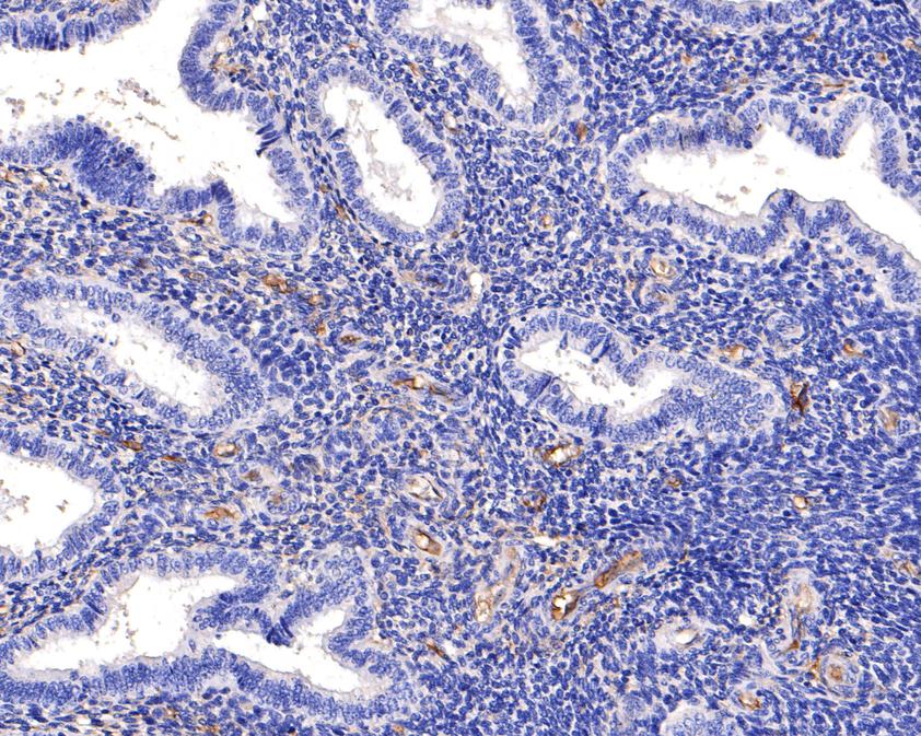 Immunohistochemical analysis of paraffin-embedded human endometrium tissue using anti-CD34 antibody. The section was pre-treated using heat mediated antigen retrieval with Tris-EDTA buffer (pH 9.0) for 20 minutes.The tissues were blocked in 1% BSA for 30 minutes at room temperature, washed with ddH2O and PBS, and then probed with the primary antibody (EM1901-01, 1/400) for 30 minutes at room temperature. The detection was performed using an HRP conjugated compact polymer system. DAB was used as the chromogen. Tissues were counterstained with hematoxylin and mounted with DPX.