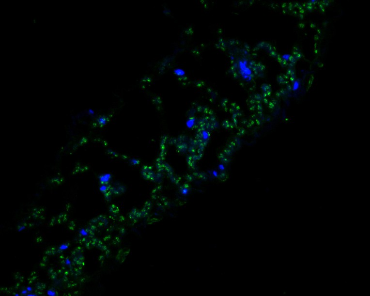 Immunofluorescence staining of paraffin- embedded A. thaliana using anti-FAB1A rabbit polyclonal antibody.The section was pre-treated using heat mediated antigen retrieval with Tris-EDTA buffer (pH 9.0) for 20 minutes. The tissues were blocked in 10% negative goat serum for 1 hour at room temperature, washed with PBS, and then probed with HA500403 at 1/100 dilution for 10 hours at 4℃ and detected using Alexa Fluor® 488 conjugate-Goat anti-Rabbit IgG (H+L) Secondary Antibody at a dilution of 1:500 for 1 hour at room temperature.