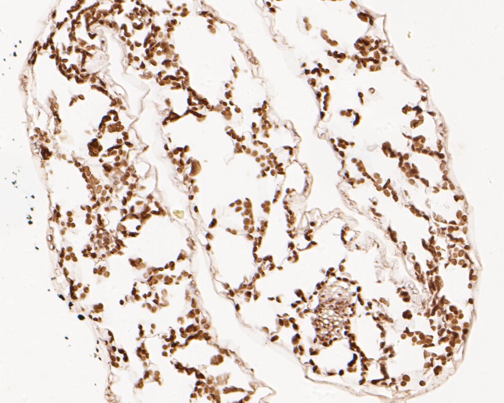 Immunohistochemical analysis of paraffin-embedded A. thaliana tissue using anti-FAB1A antibody. The section was pre-treated using heat mediated antigen retrieval with Tris-EDTA buffer (pH 9.0) for 20 minutes.The tissues were blocked in 5% BSA for 30 minutes at room temperature, washed with ddH2O and PBS, and then probed with the primary antibody (HA500403, 1/50) for 30 minutes at room temperature. The detection was performed using an HRP conjugated compact polymer system. DAB was used as the chromogen. Tissues were counterstained with hematoxylin and mounted with DPX.