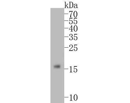 Western blot analysis of TNNC1 on human heart tissue lysates. Proteins were transferred to a PVDF membrane and blocked with 5% NFDM/TBST for 1 hour at room temperature. The primary antibody (HA500407, 1/200) was used in 5% NFDM/TBST at room temperature for 2 hours. Goat Anti-Rabbit IgG - HRP Secondary Antibody (HA1001) at 1:5,000 dilution was used for 1 hour at room temperature.