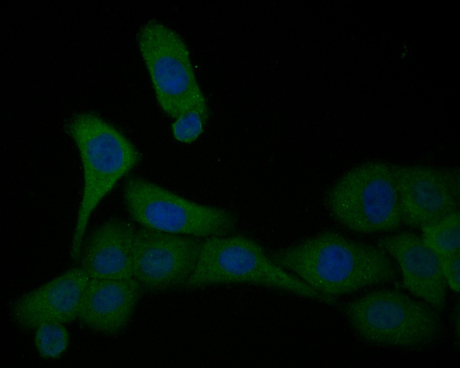 ICC staining of TNNC1 in SKOV-3 cells (green). Formalin fixed cells were permeabilized with 0.1% Triton X-100 in TBS for 10 minutes at room temperature and blocked with 1% Blocker BSA for 15 minutes at room temperature. Cells were probed with the primary antibody (HA500407, 1/100) for 1 hour at room temperature, washed with PBS. Alexa Fluor®488 Goat anti-Rabbit IgG was used as the secondary antibody at 1/1,000 dilution. The nuclear counter stain is DAPI (blue).