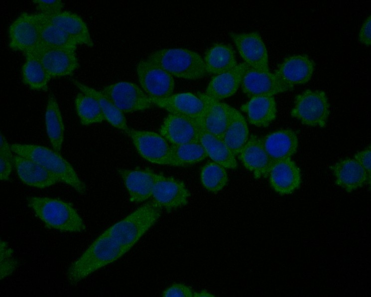 ICC staining of TNNC1 in SW620 cells (green). Formalin fixed cells were permeabilized with 0.1% Triton X-100 in TBS for 10 minutes at room temperature and blocked with 1% Blocker BSA for 15 minutes at room temperature. Cells were probed with the primary antibody (HA500407, 1/100) for 1 hour at room temperature, washed with PBS. Alexa Fluor®488 Goat anti-Rabbit IgG was used as the secondary antibody at 1/1,000 dilution. The nuclear counter stain is DAPI (blue).