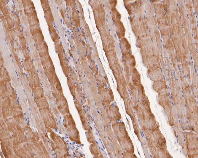 Immunohistochemical analysis of paraffin-embedded rat skeletal muscle tissue using anti-TNNC1 antibody. The section was pre-treated using heat mediated antigen retrieval with Tris-EDTA buffer (pH 8.0-8.4) for 20 minutes.The tissues were blocked in 5% BSA for 30 minutes at room temperature, washed with ddH2O and PBS, and then probed with the primary antibody (HA500407, 1/200) for 30 minutes at room temperature. The detection was performed using an HRP conjugated compact polymer system. DAB was used as the chromogen. Tissues were counterstained with hematoxylin and mounted with DPX.