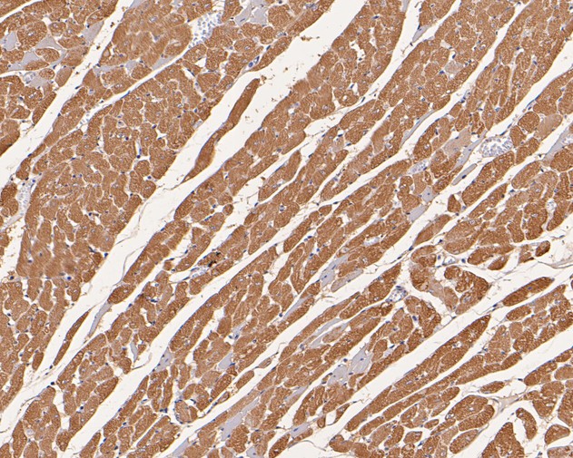 Immunohistochemical analysis of paraffin-embedded rat heart tissue using anti-TNNC1 antibody. The section was pre-treated using heat mediated antigen retrieval with Tris-EDTA buffer (pH 8.0-8.4) for 20 minutes.The tissues were blocked in 5% BSA for 30 minutes at room temperature, washed with ddH2O and PBS, and then probed with the primary antibody (HA500407, 1/200) for 30 minutes at room temperature. The detection was performed using an HRP conjugated compact polymer system. DAB was used as the chromogen. Tissues were counterstained with hematoxylin and mounted with DPX.