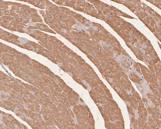 Immunohistochemical analysis of paraffin-embedded mouse heart tissue using anti-TNNC1 antibody. The section was pre-treated using heat mediated antigen retrieval with Tris-EDTA buffer (pH 8.0-8.4) for 20 minutes.The tissues were blocked in 5% BSA for 30 minutes at room temperature, washed with ddH2O and PBS, and then probed with the primary antibody (HA500407, 1/200) for 30 minutes at room temperature. The detection was performed using an HRP conjugated compact polymer system. DAB was used as the chromogen. Tissues were counterstained with hematoxylin and mounted with DPX.