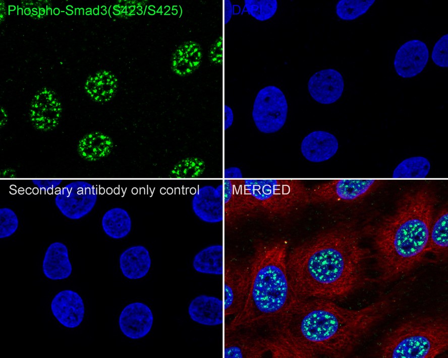 ICC staining Phospho-Smad3(S423/S425) (1/50) in A431 cells (green). The nuclear counter stain is DAPI (blue). Cells were fixed in paraformaldehyde, permeabilised with 0.25% Triton X100/PBS.