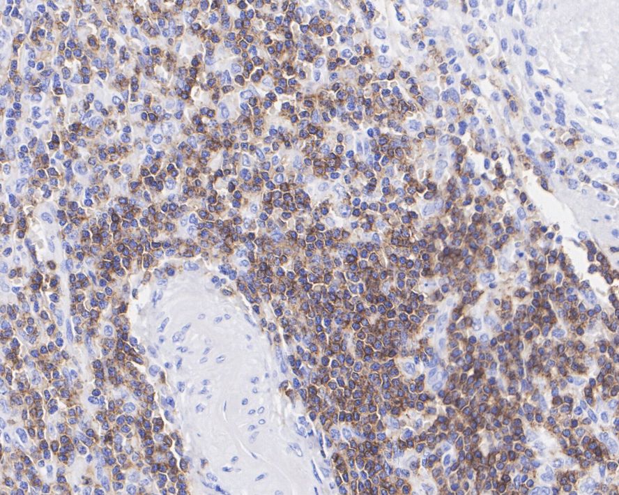 Immunohistochemical analysis of paraffin-embedded human spleen tissue using anti-CD3 epsilon antibody. The section was pre-treated using heat mediated antigen retrieval with Tris-EDTA buffer (pH 9.0) for 20 minutes.The tissues were blocked in 5% BSA for 30 minutes at room temperature, washed with ddH2O and PBS, and then probed with the primary antibody (ET1607-29, 1/200) for 30 minutes at room temperature. The detection was performed using an HRP conjugated compact polymer system. DAB was used as the chromogen. Tissues were counterstained with hematoxylin and mounted with DPX.