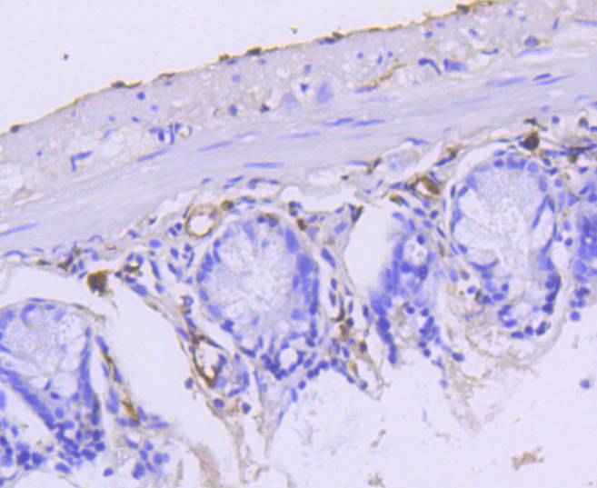 Immunohistochemical analysis of paraffin-embedded mouse small intestine tissue using anti-Cytokeratin 15 antibody. The section was pre-treated using heat mediated antigen retrieval with Tris-EDTA buffer (pH 8.0-8.4) for 20 minutes.The tissues were blocked in 5% BSA for 30 minutes at room temperature, washed with ddH2O and PBS, and then probed with the primary antibody (ET1609-54, 1/50) for 30 minutes at room temperature. The detection was performed using an HRP conjugated compact polymer system. DAB was used as the chromogen. Tissues were counterstained with hematoxylin and mounted with DPX.
