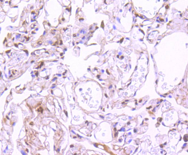 Immunohistochemical analysis of paraffin-embedded human lung tissue using anti-Phospho-STAT3 (S727) antibody. The section was pre-treated using heat mediated antigen retrieval with Tris-EDTA buffer (pH 8.0-8.4) for 20 minutes.The tissues were blocked in 5% BSA for 30 minutes at room temperature, washed with ddH2O and PBS, and then probed with the primary antibody (ET1607-39, 1/50) for 30 minutes at room temperature. The detection was performed using an HRP conjugated compact polymer system. DAB was used as the chromogen. Tissues were counterstained with hematoxylin and mounted with DPX.