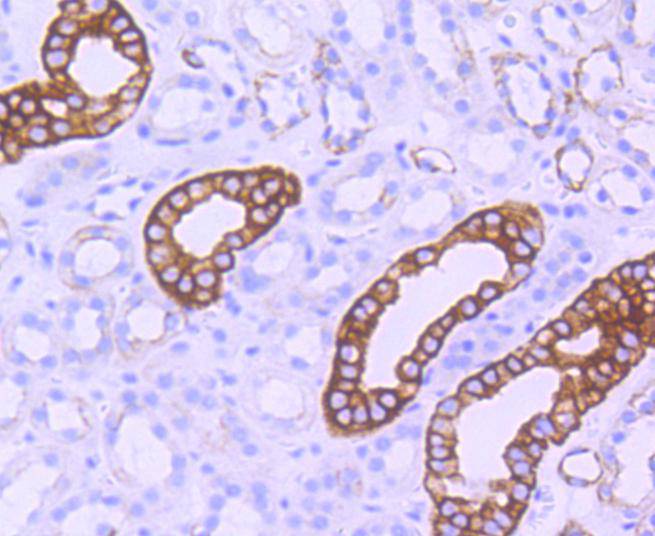 Immunohistochemical analysis of paraffin-embedded human pancreas tissue using anti-Phospho-GSK3 beta(Ser 9) antibody. The section was pre-treated using heat mediated antigen retrieval with Tris-EDTA buffer (pH 8.0-8.4) for 20 minutes.The tissues were blocked in 5% BSA for 30 minutes at room temperature, washed with ddH2O and PBS, and then probed with the primary antibody (ET1607-60, 1/50) for 30 minutes at room temperature. The detection was performed using an HRP conjugated compact polymer system. DAB was used as the chromogen. Tissues were counterstained with hematoxylin and mounted with DPX.