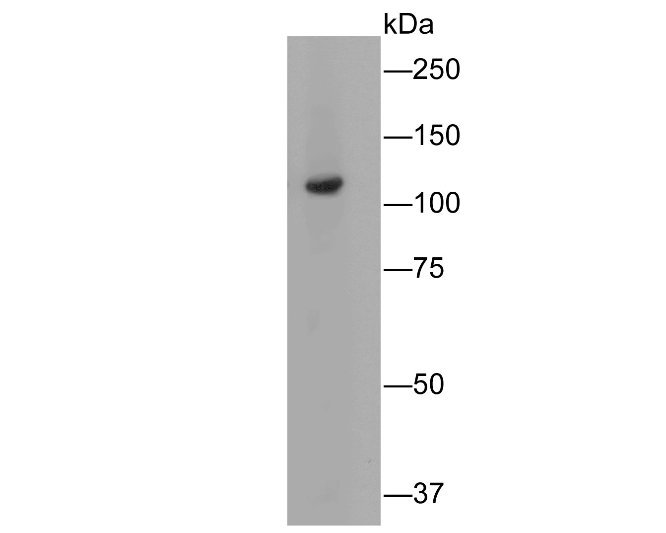 Western blot analysis of Butyrylcholine esterase on human skin tissue lysates. Proteins were transferred to a PVDF membrane and blocked with 5% BSA in PBS for 1 hour at room temperature. The primary antibody (HA500248, 1/1,000) was used in 5% BSA at room temperature for 2 hours. Goat Anti-Rabbit IgG - HRP Secondary Antibody (HA1001) at 1:5,000 dilution was used for 1 hour at room temperature.<br />
<br />
Predicted band size: 68 kDa<br />
Observed band size: 110 kDa (Glycosylation)