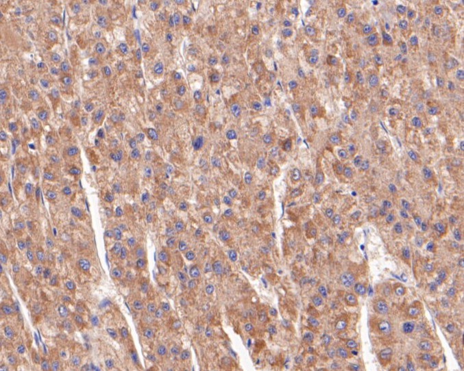 Immunohistochemical analysis of paraffin-embedded human liver tissue using anti-Butyrylcholine esterase antibody. The section was pre-treated using heat mediated antigen retrieval with Tris-EDTA buffer (pH 8.0-8.4) for 20 minutes.The tissues were blocked in 5% BSA for 30 minutes at room temperature, washed with ddH2O and PBS, and then probed with the primary antibody (HA500248, 1/100) for 30 minutes at room temperature. The detection was performed using an HRP conjugated compact polymer system. DAB was used as the chromogen. Tissues were counterstained with hematoxylin and mounted with DPX.