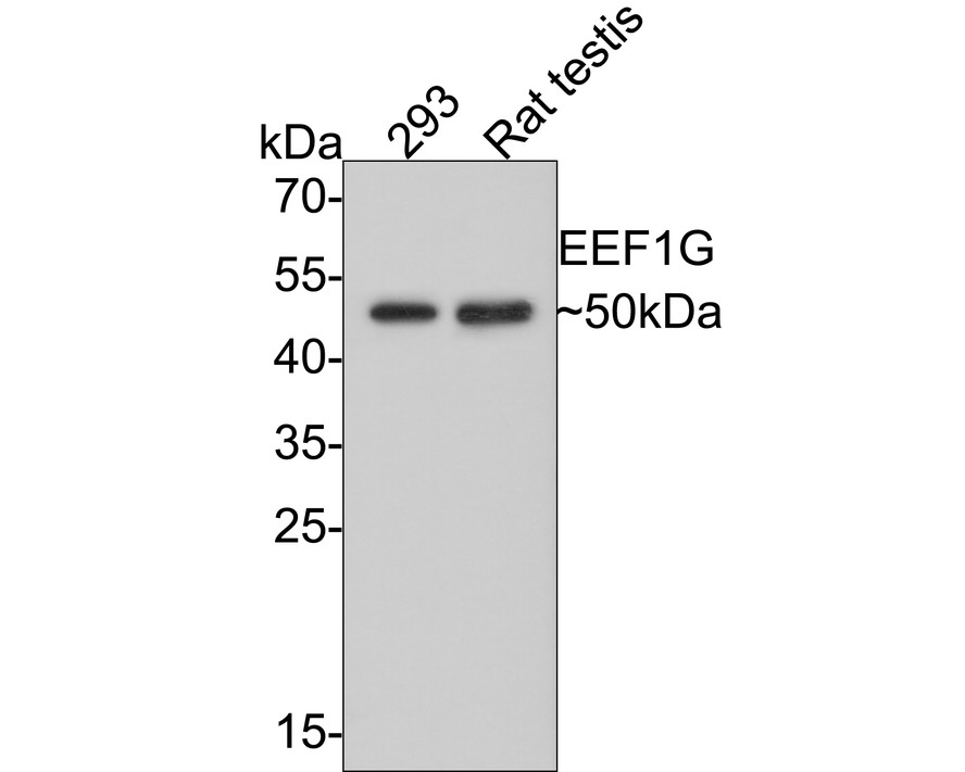 Western blot analysis of EEF1G on different lysates with Rabbit anti-EEF1G antibody (HA500164) at 1/500 dilution.<br />
<br />
Lane 1: 293 cell lysate (10 µg/Lane)<br />
Lane 2: Rat testis tissue lysate (20 µg/Lane)<br />
<br />
Predicted band size: 50 kDa<br />
Observed band size: 50 kDa<br />
<br />
Exposure time: 2 minutes;<br />
<br />
12% SDS-PAGE gel.<br />
<br />
Proteins were transferred to a PVDF membrane and blocked with 5% NFDM/TBST for 1 hour at room temperature. The primary antibody (HA500164) at 1/500 dilution was used in 5% NFDM/TBST at room temperature for 2 hours. Goat Anti-Rabbit IgG - HRP Secondary Antibody (HA1001) at 1:300,000 dilution was used for 1 hour at room temperature.