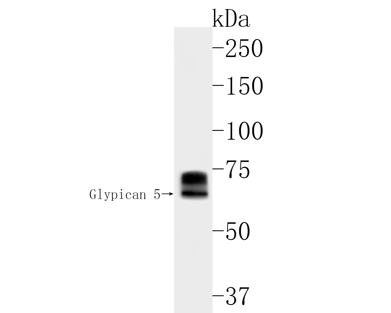 Western blot analysis of Glypican 5 on mouse lung tissue lysates. Proteins were transferred to a PVDF membrane and blocked with 5% BSA in PBS for 1 hour at room temperature. The primary antibody (HA500174, 1/500) was used in 5% BSA at room temperature for 2 hours. Goat Anti-Rabbit IgG - HRP Secondary Antibody (HA1001) at 1:200,000 dilution was used for 1 hour at room temperature.<br />
<br />
Predicted band size: 64 kDa<br />
Observed band size: 64/70 kDa