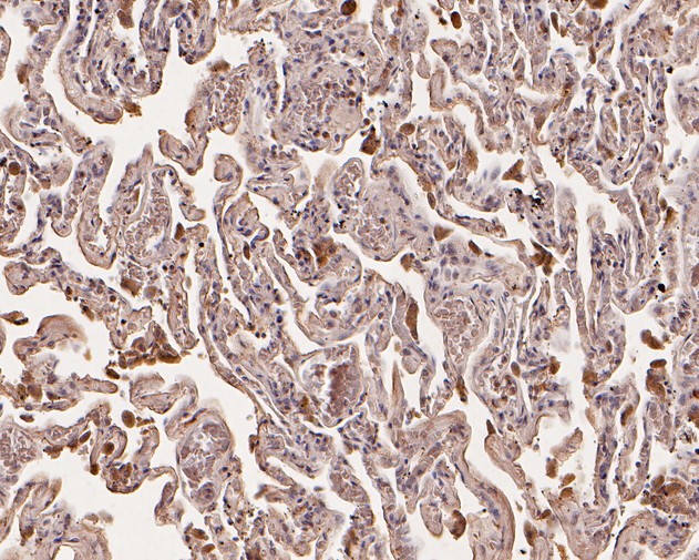 Immunohistochemical analysis of paraffin-embedded human lung tissue using anti-Glypican 5 antibody. The section was pre-treated using heat mediated antigen retrieval with Tris-EDTA buffer (pH 8.0-8.4) for 20 minutes.The tissues were blocked in 5% BSA for 30 minutes at room temperature, washed with ddH2O and PBS, and then probed with the primary antibody (HA500174, 1/800) for 30 minutes at room temperature. The detection was performed using an HRP conjugated compact polymer system. DAB was used as the chromogen. Tissues were counterstained with hematoxylin and mounted with DPX.
