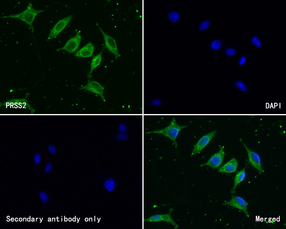 ICC staining of PRSS2 in SH-SY5Y cells (green). Methanol fixed cells were blocked with 10% negative goat serum for 15 minutes at room temperature. Cells were probed with the primary antibody (HA500182, 1/200) for 1 hour at room temperature, washed with PBS. Alexa Fluor®488 conjugate-Goat anti-Rabbit IgG was used as the secondary antibody at 1/1,000 dilution. The nuclear counter stain is DAPI (blue).